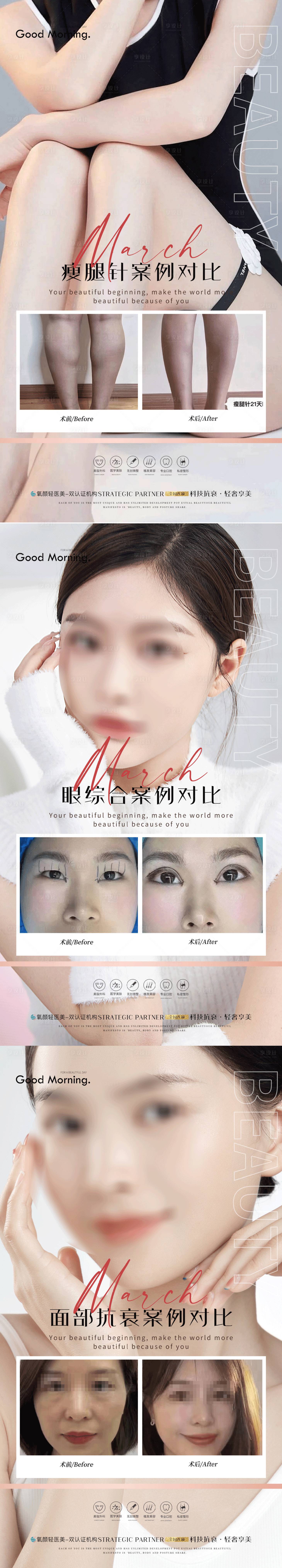 源文件下载【整形案例简约系列海报】编号：94400019284857142