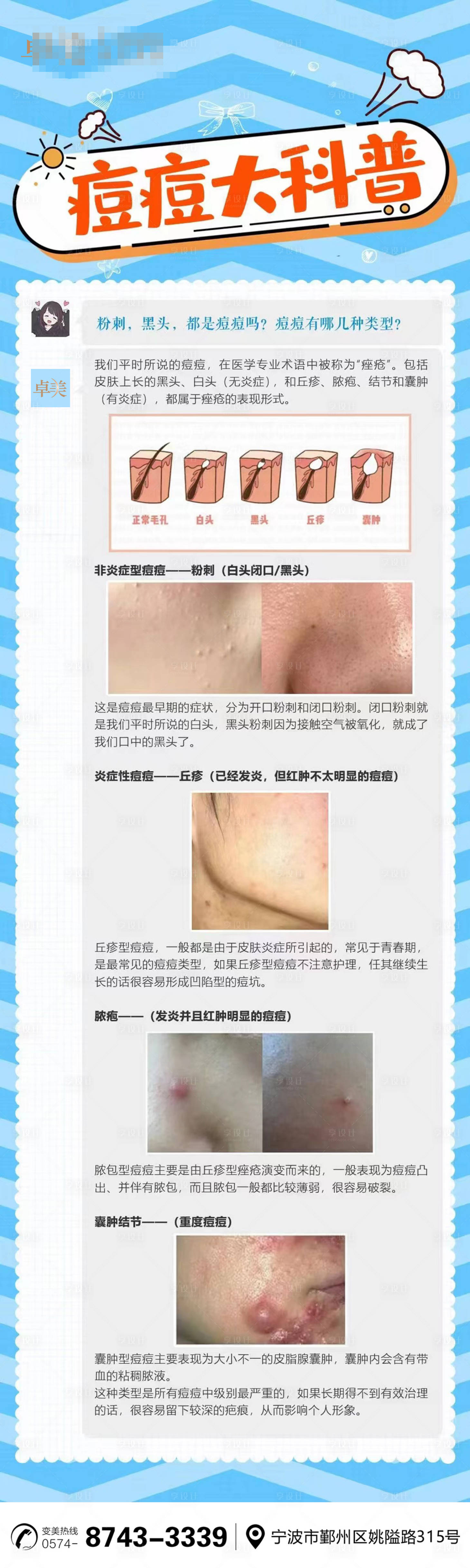 源文件下载【医美祛痘科普】编号：53140019244536512