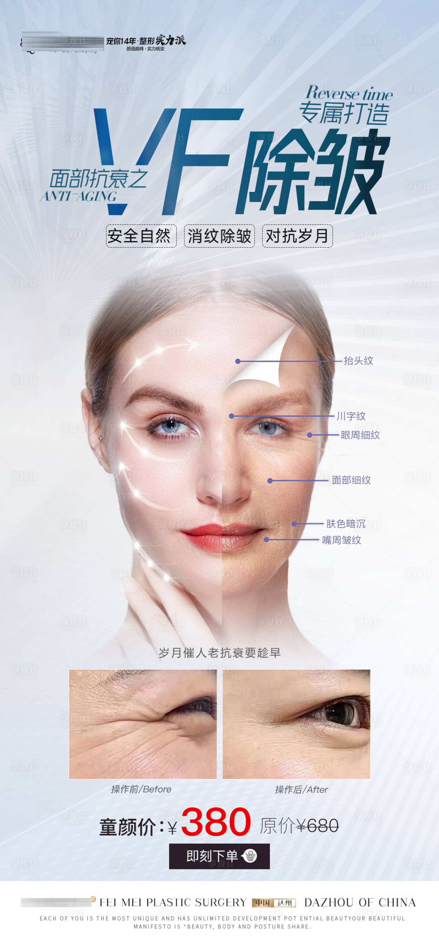 源文件下载【医美除皱针案例活动海报】编号：20310019118073486