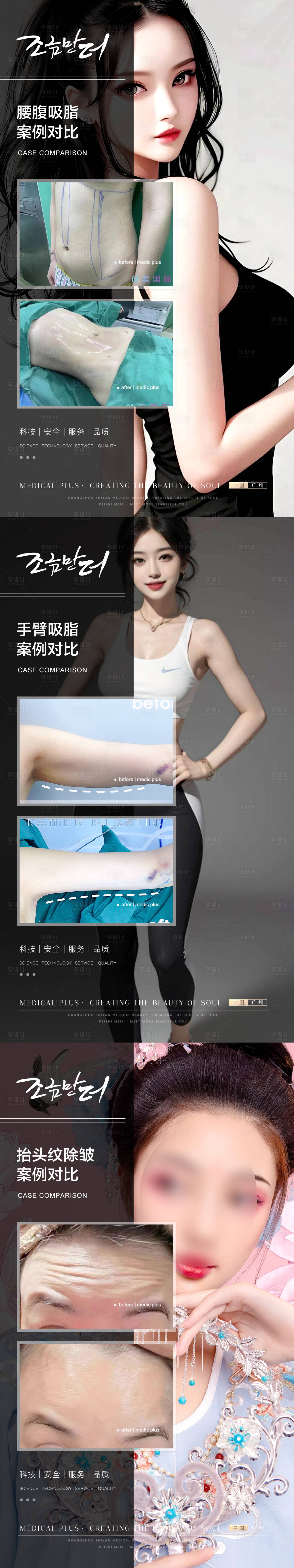 源文件下载【医美案例对比海报】编号：24460019408743442