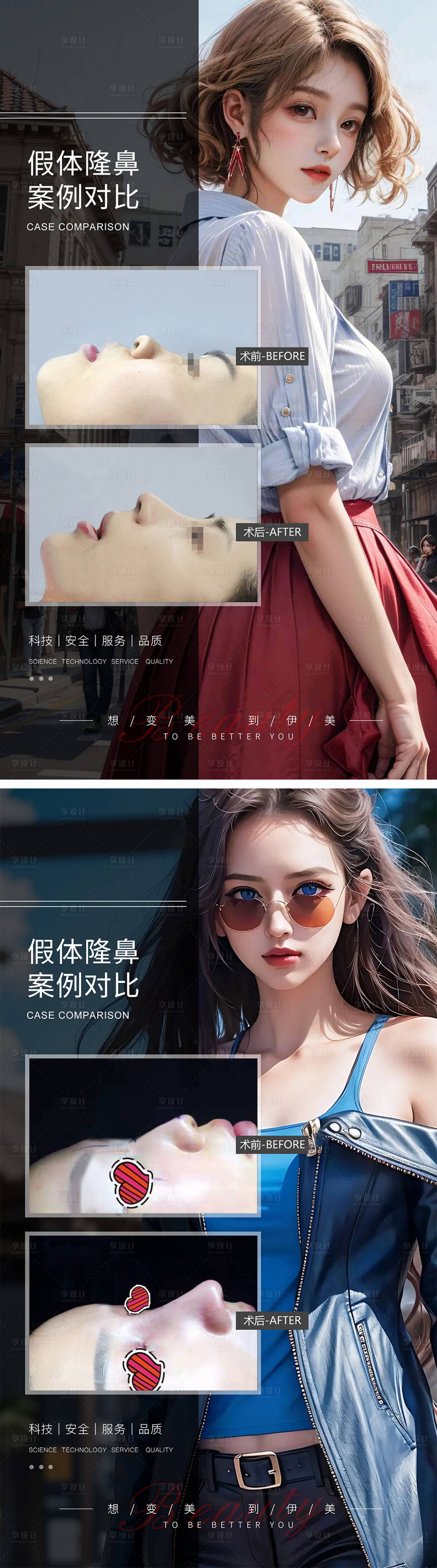 源文件下载【享设计】搜索编号：19040019324492109【假体隆鼻案例对比】