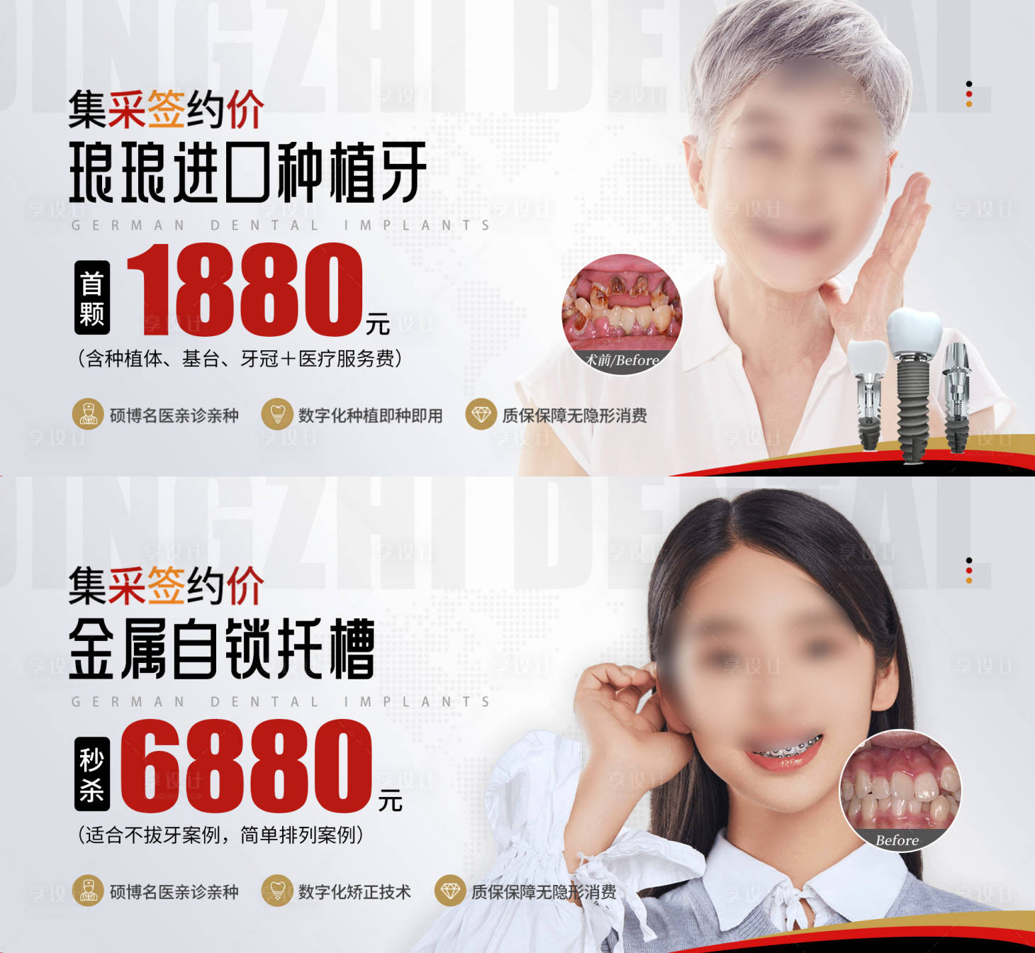 源文件下载【种植牙矫正活动banner】编号：83820019370452111