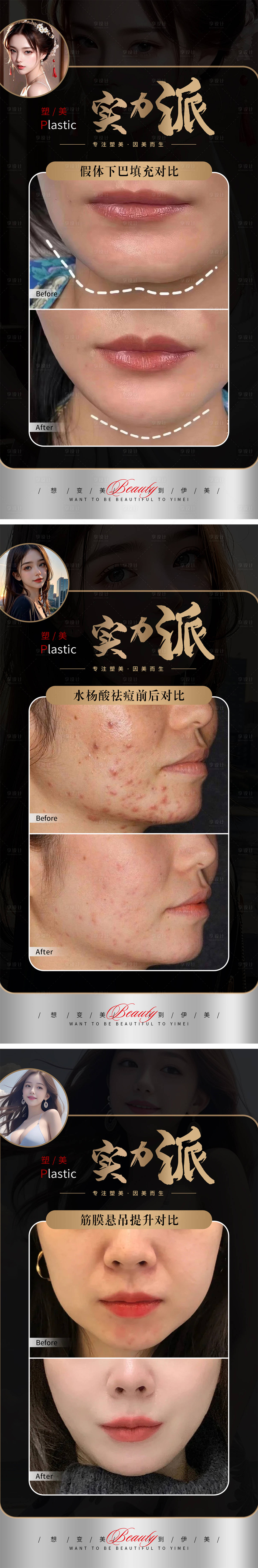 源文件下載【享設計】搜索編號：67810019228208849【醫美案例對比海報】