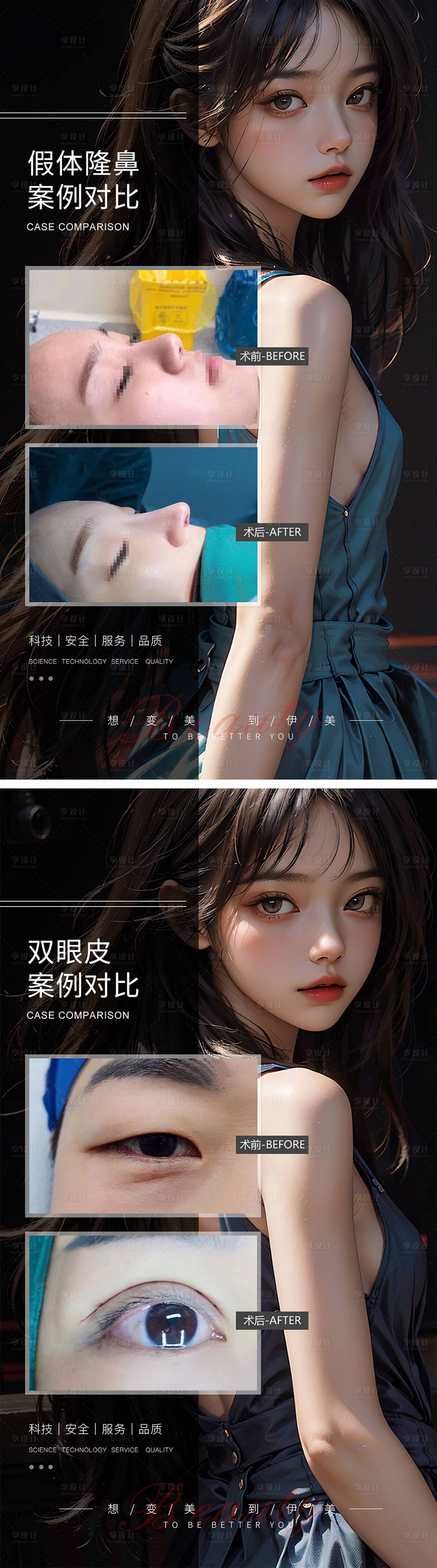 源文件下載【享設(shè)計(jì)】搜索編號(hào)：99170019492767563【隆鼻雙眼皮案例對(duì)比】
