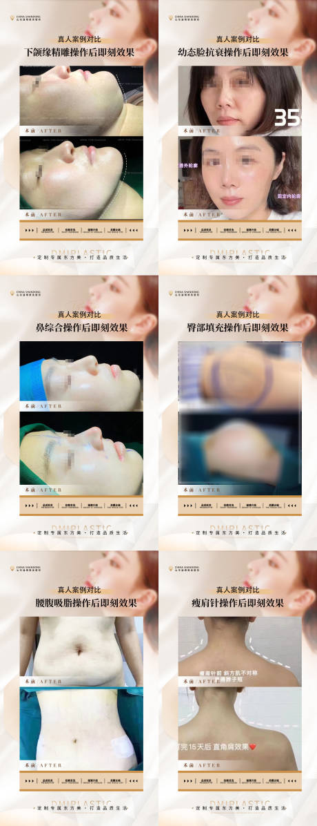 源文件下载【医美案例】编号：66120019240724045