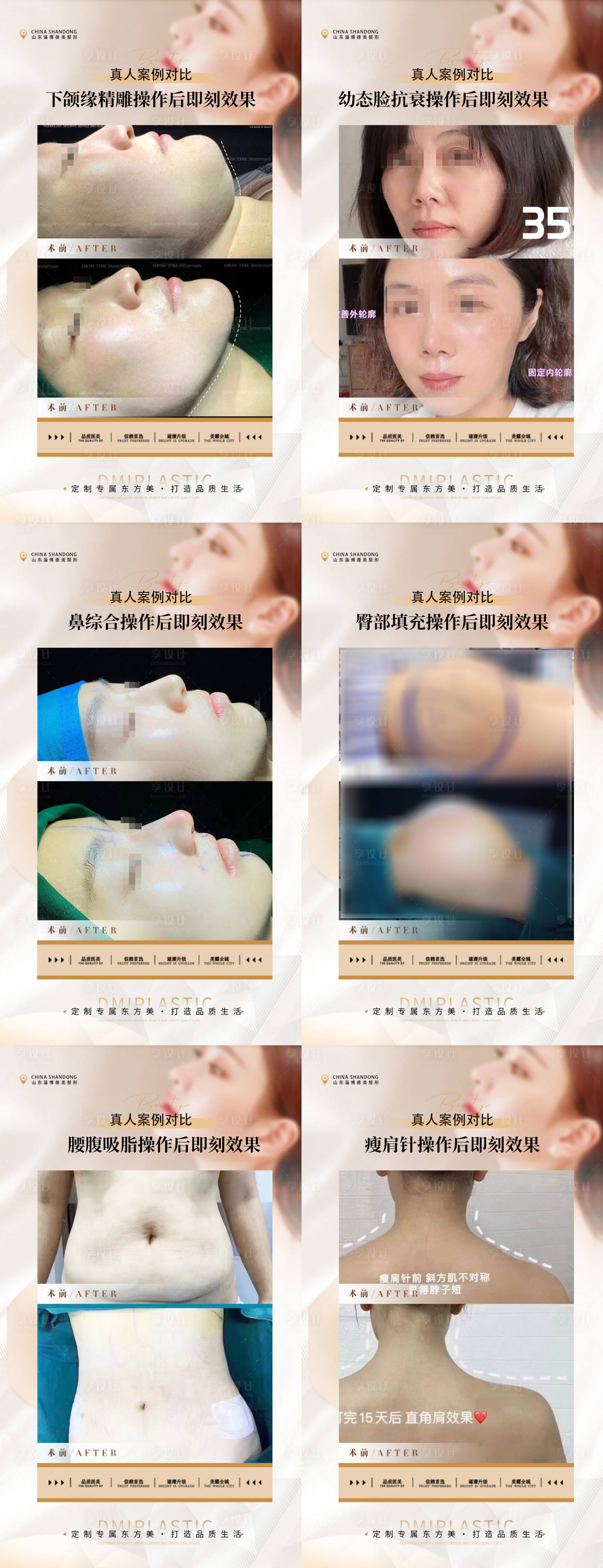 源文件下载【医美案例】编号：66120019240724045
