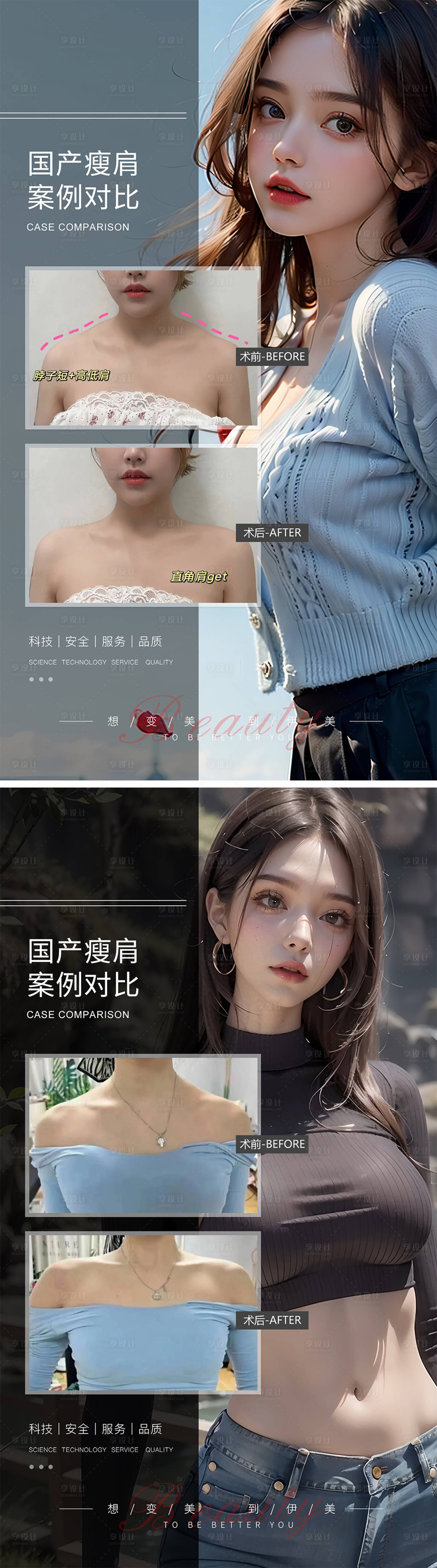 源文件下载【瘦肩针案例对比系列海报】编号：97390019235658059