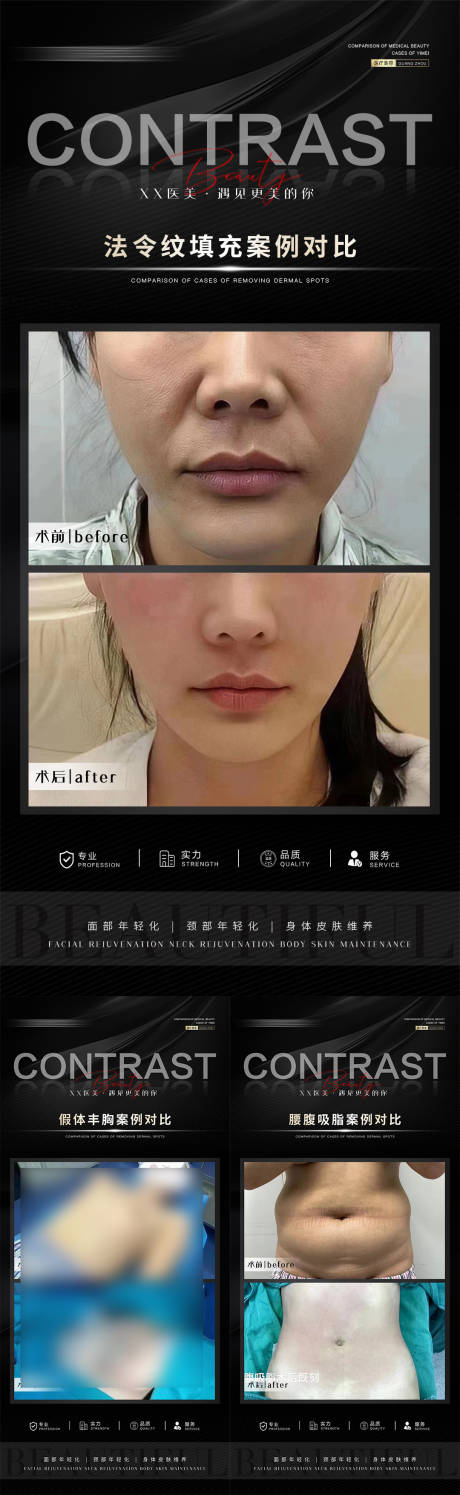 源文件下载【整形黑金案例对比海报】编号：56490019573472931