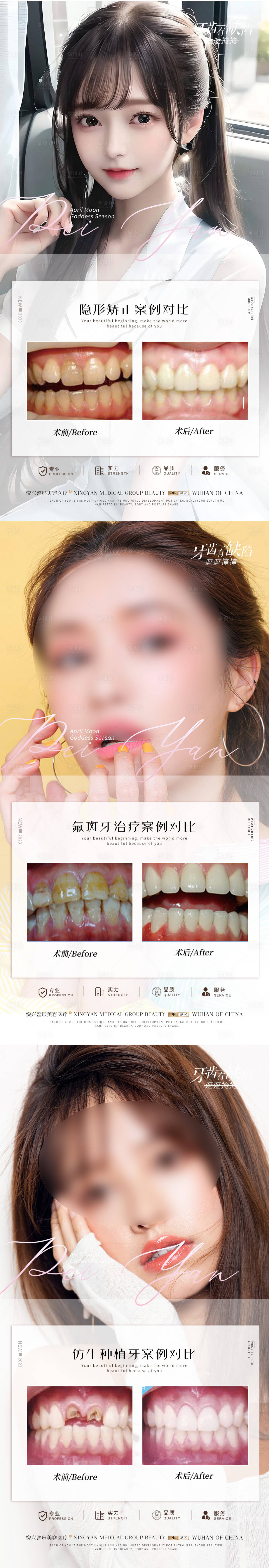 源文件下载【口腔案例系列海报】编号：79740019408723229
