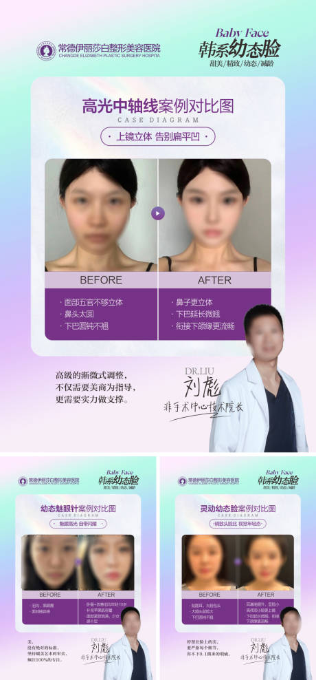 源文件下載【享設(shè)計(jì)】搜索編號(hào)：44650019517989089【醫(yī)美幼態(tài)臉案例展板】