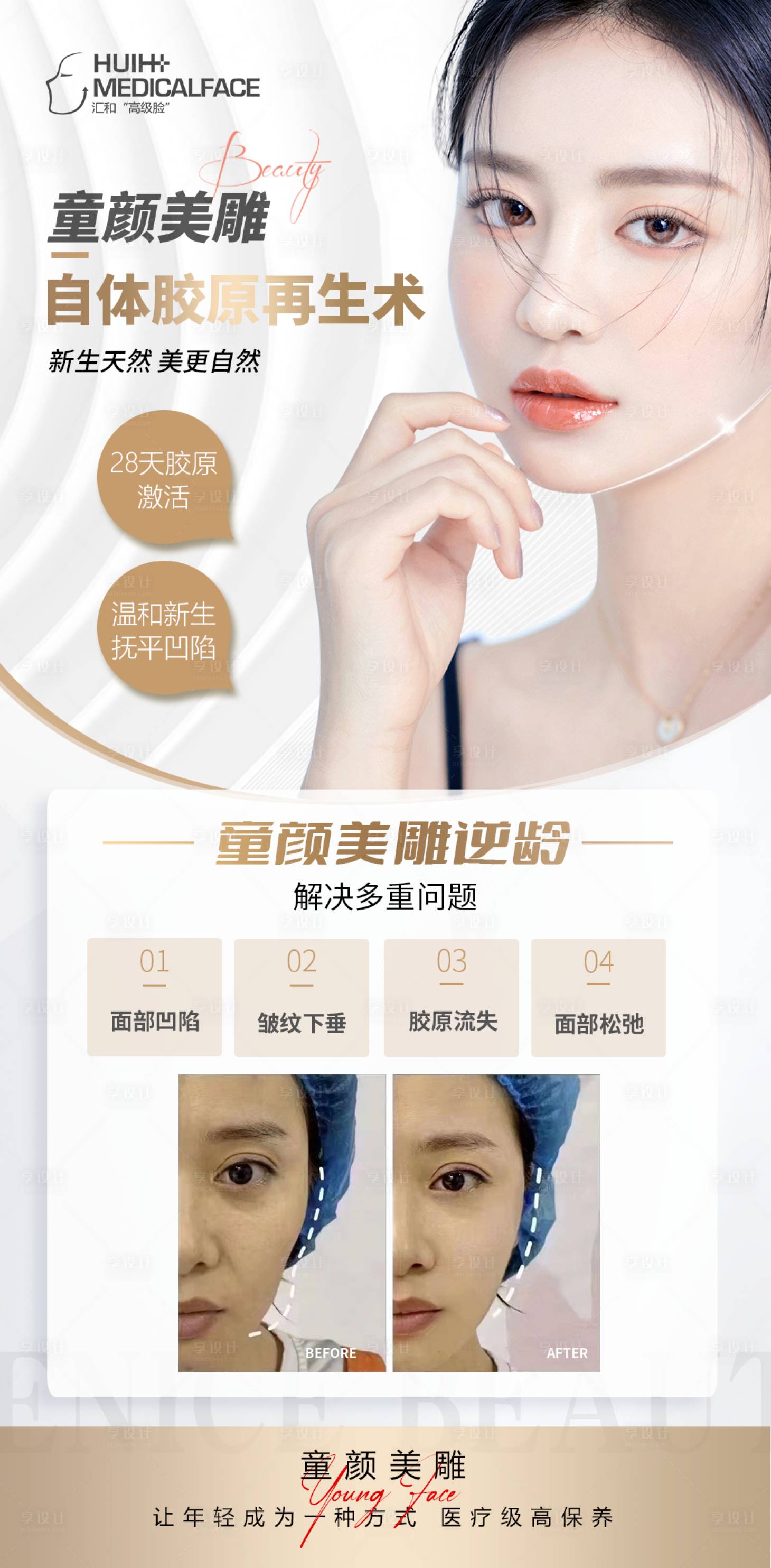 源文件下载【享设计】搜索编号：96240019161756970【轻医美海报】