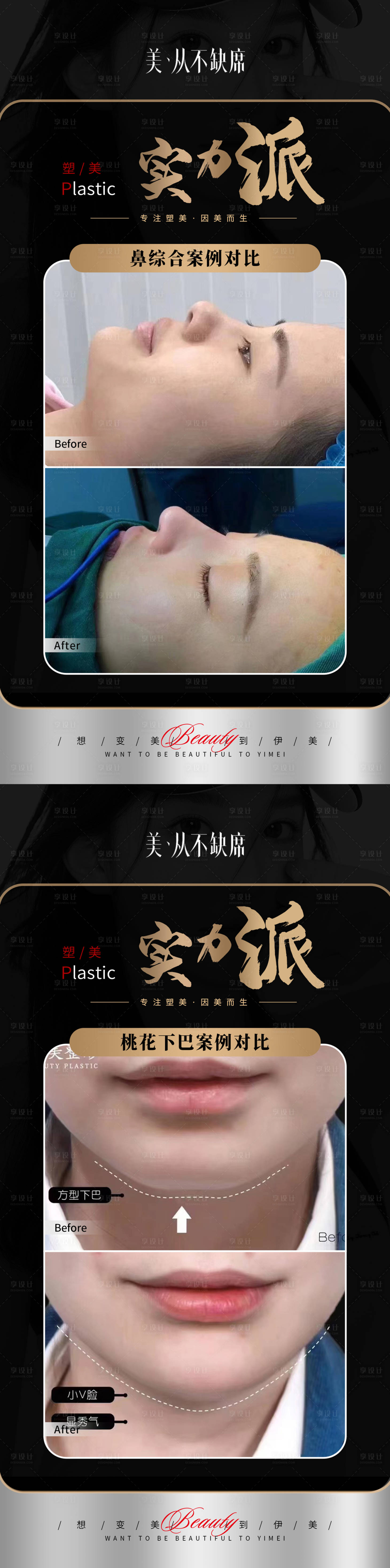 源文件下載【享設計】搜索編號：23090019149289004【醫美黑金案例】