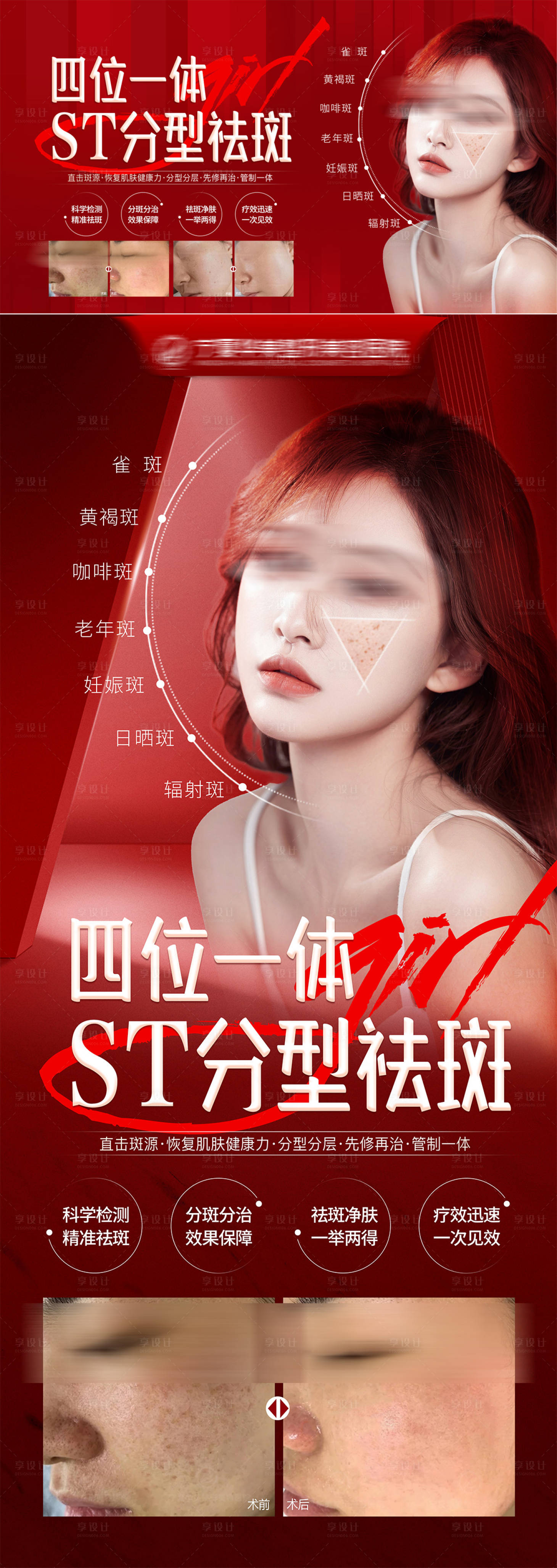 源文件下載【享設(shè)計】搜索編號：79610019364462440【分型祛斑海報】
