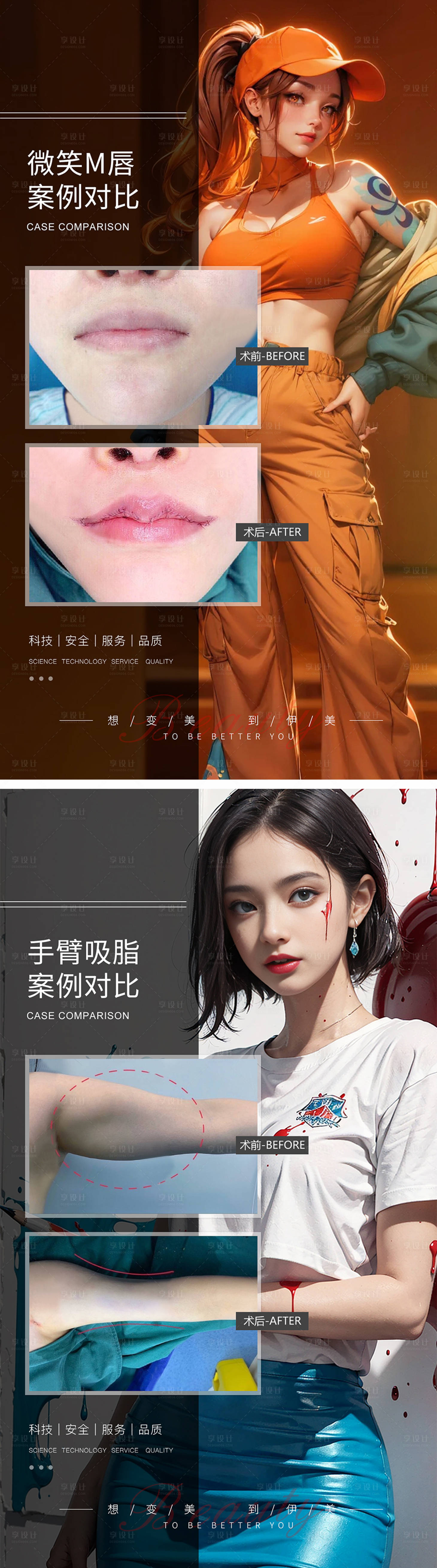 源文件下载【享设计】搜索编号：49940019491638014【微笑M唇手臂吸脂案例对比】