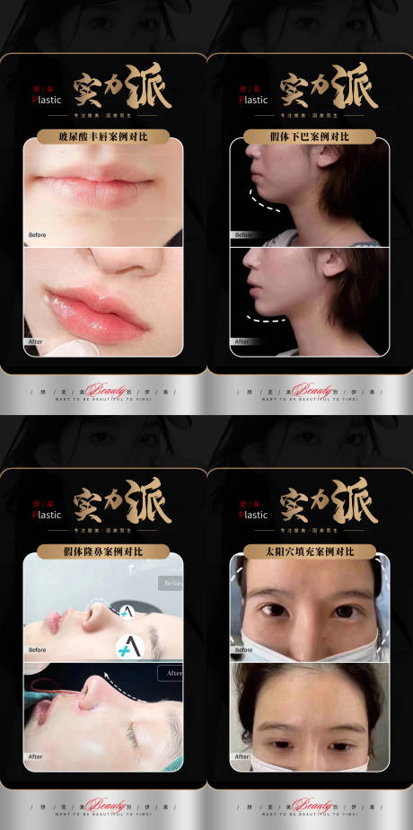 源文件下载【医美黑金案例】编号：63820019240787454
