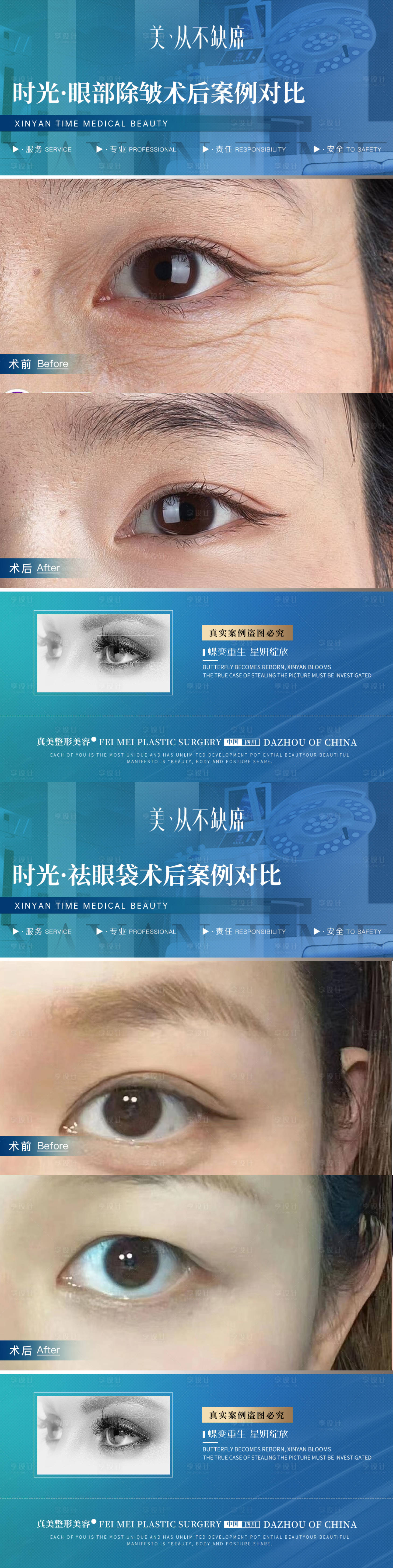 源文件下载【医美眼部除皱祛眼袋案例对比海报】编号：94560019451779175
