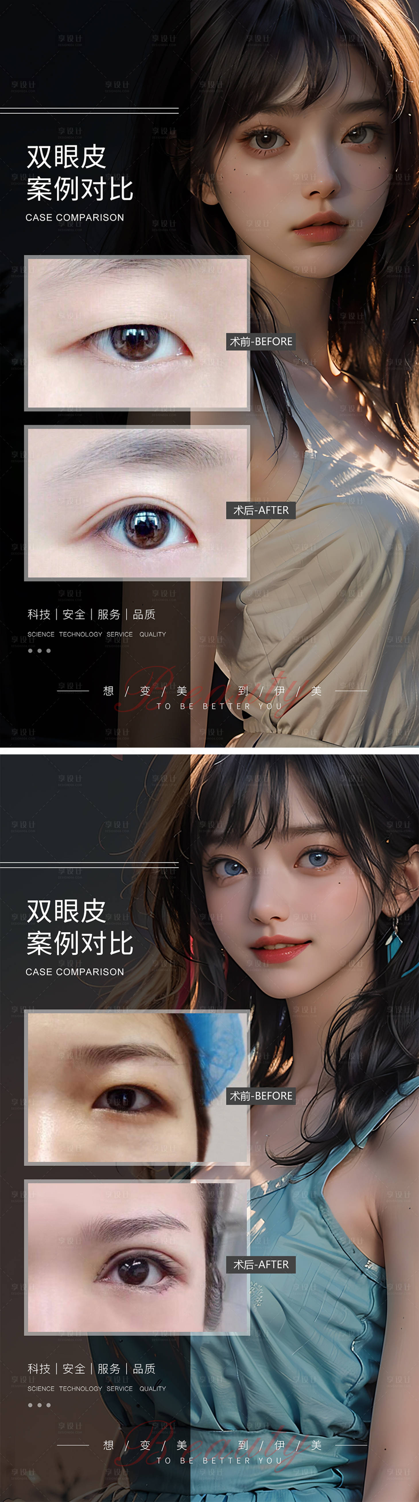 源文件下载【享设计】搜索编号：48530019296896612【双眼皮案例对比海报】