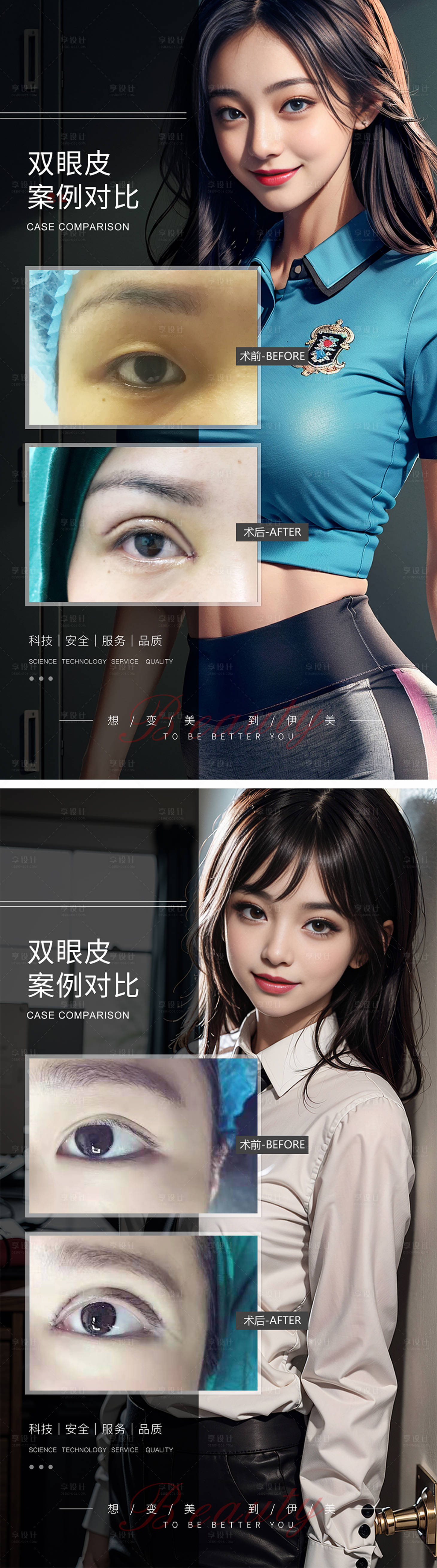 源文件下载【享设计】搜索编号：98700019358798511【双眼皮案例对比海报】