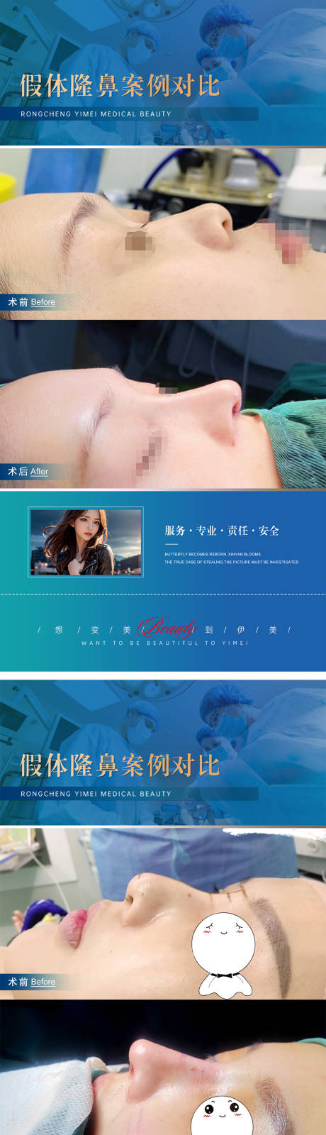 源文件下載【享設計】搜索編號：56510019560303322【醫美整形案例對比海報】