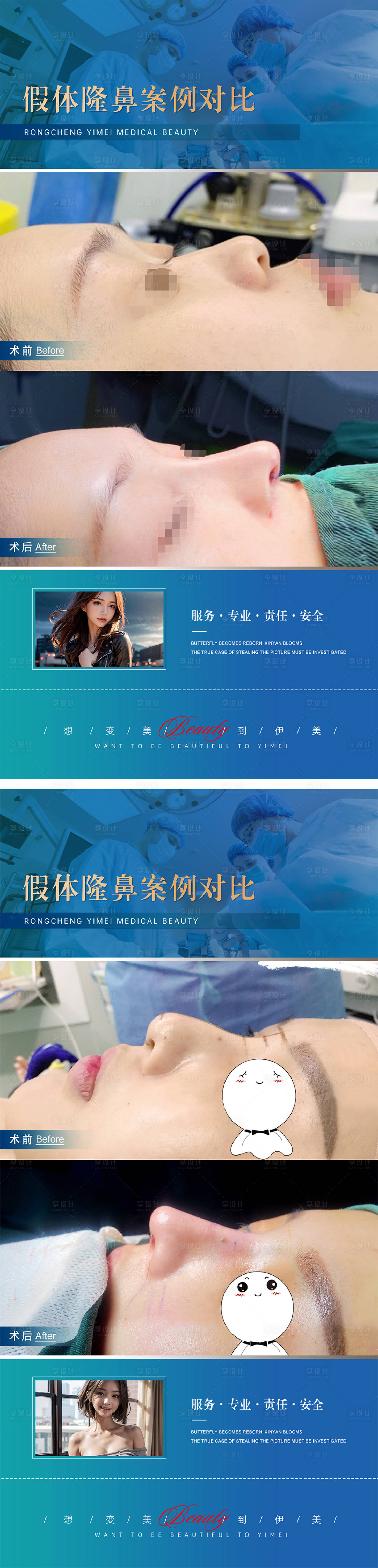 源文件下载【享设计】搜索编号：56510019560303322【医美整形案例对比海报】