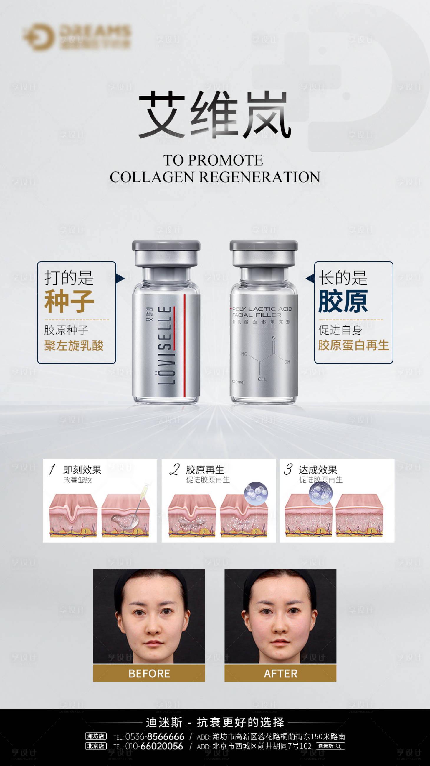 源文件下載【享設計】搜索編號：78930019308667016【醫美產品-艾維嵐童顏針】