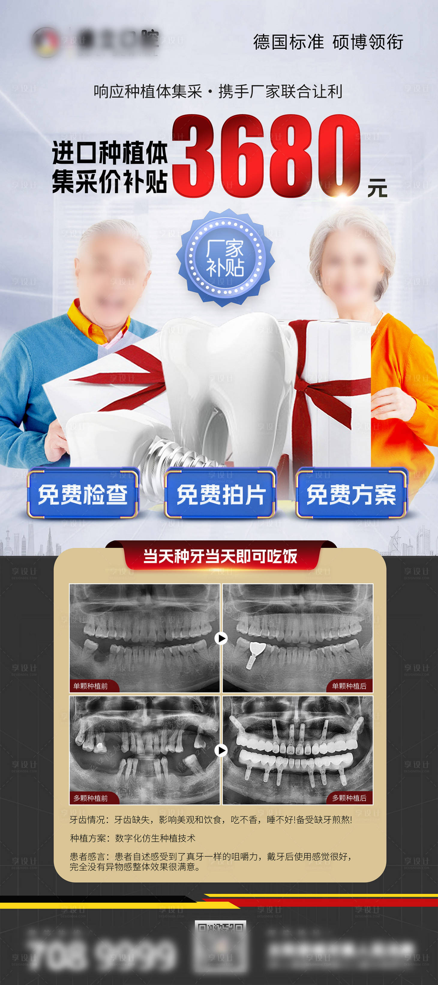 源文件下載【享設計】搜索編號：88260019279633033【牙齒活動種植牙展架】