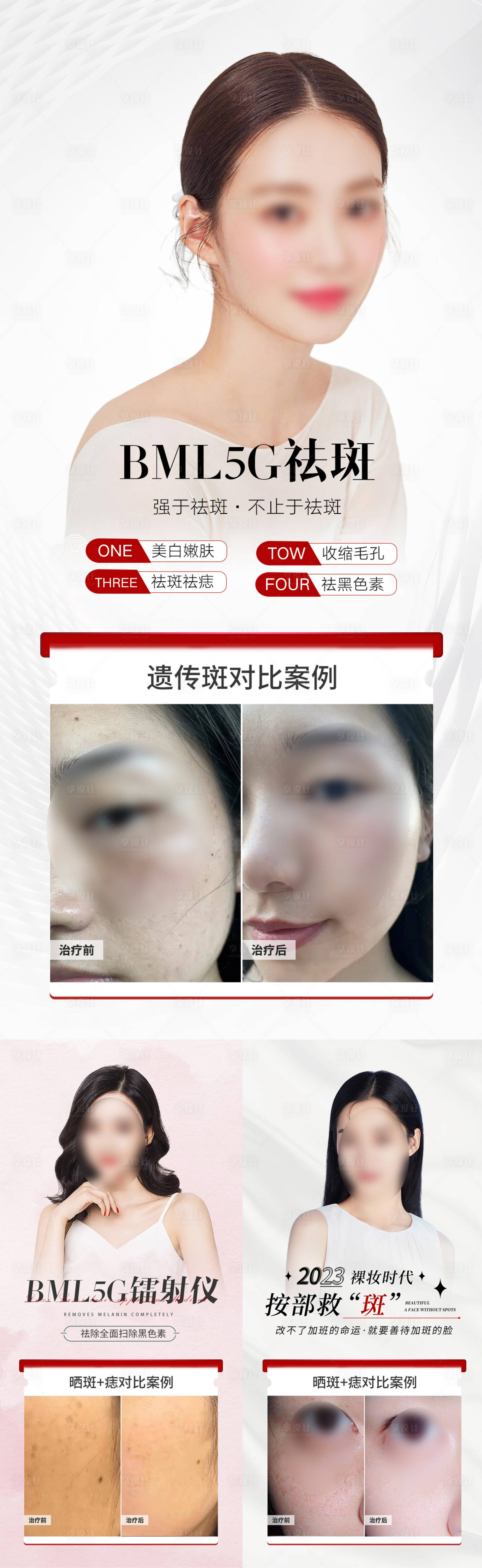 源文件下載【享設(shè)計】搜索編號：91140019561367581【輕醫(yī)美祛斑皮膚管理案例海報】
