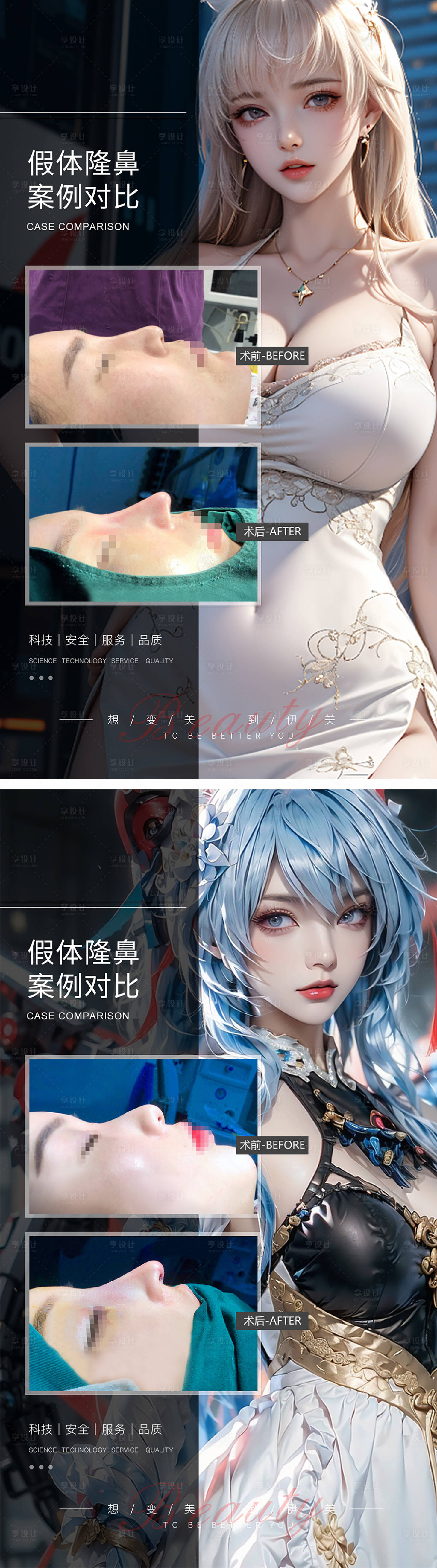 源文件下載【享設計】搜索編號：42500019490892987【假體隆鼻案例對比】