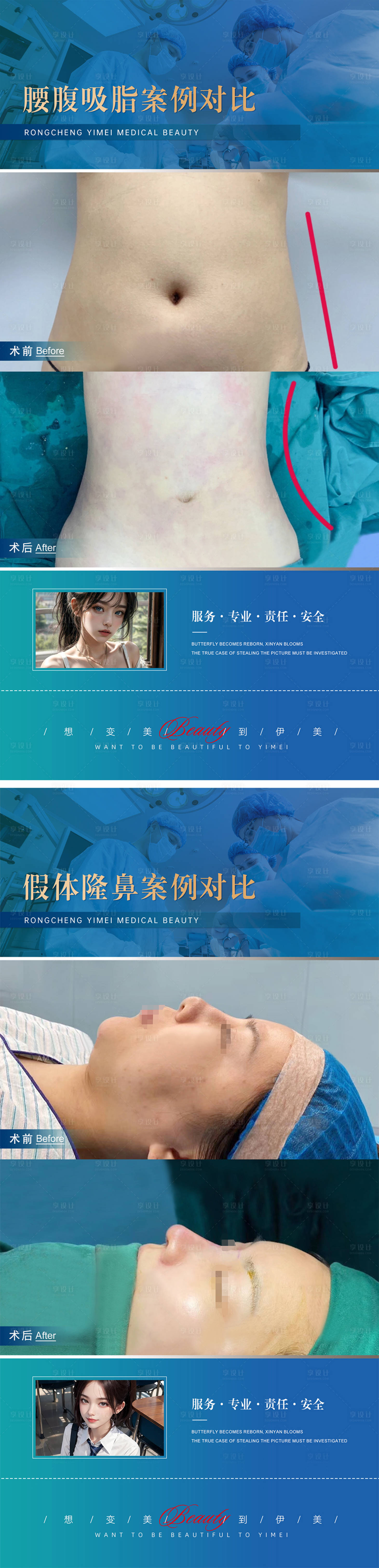 源文件下載【享設計】搜索編號：75990019552993681【醫美整形案例對比模版】