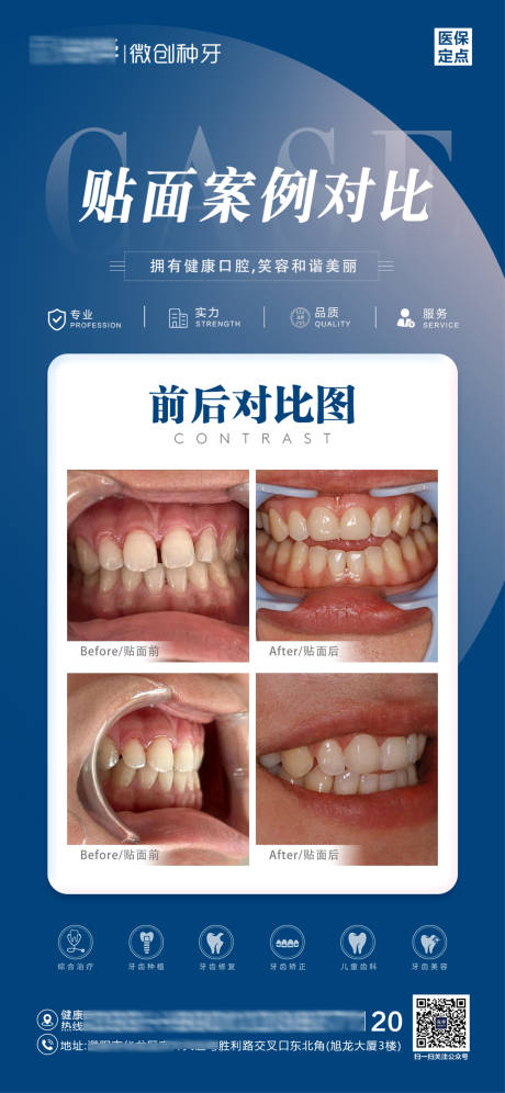 源文件下載【貼面案例對(duì)比圖】編號(hào)：51770019333844534