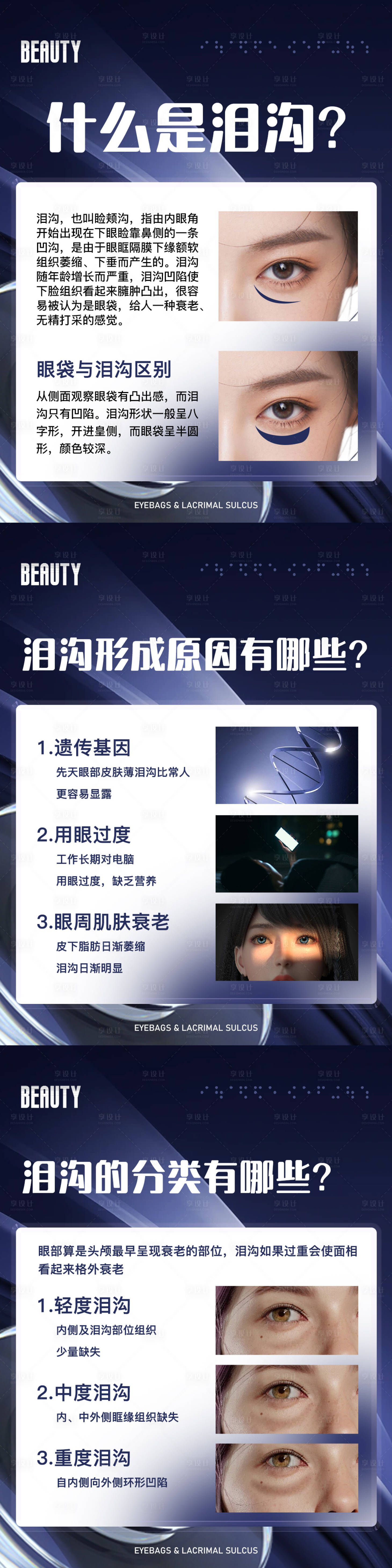 源文件下載【享設計】搜索編號：26900019254154573【醫美淚溝科普系列海報】