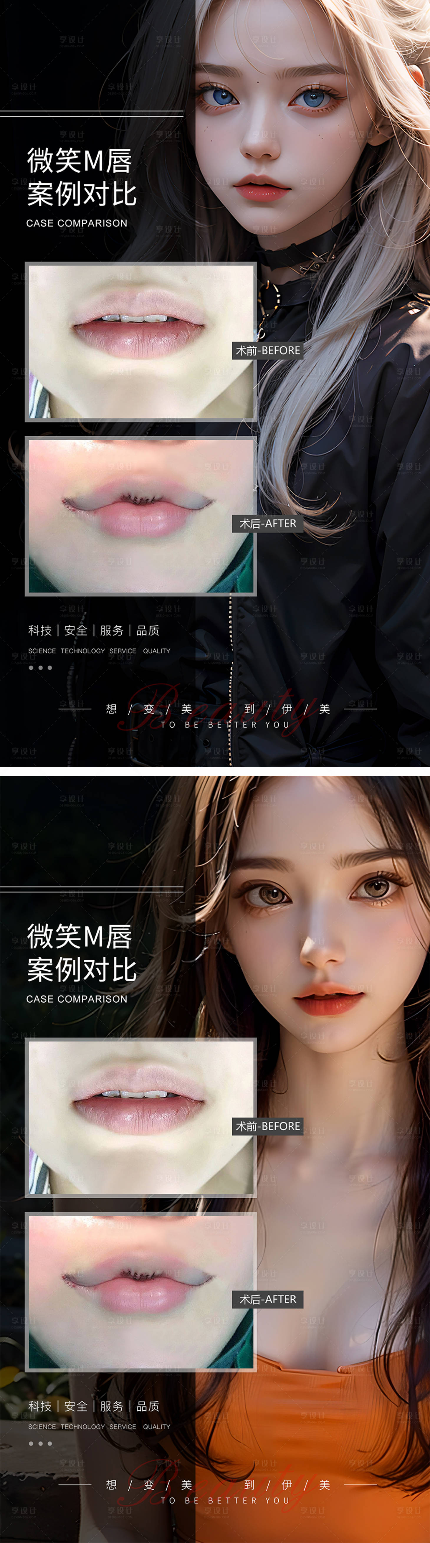 源文件下载【享设计】搜索编号：49550019370728772【微笑M唇案例对比】