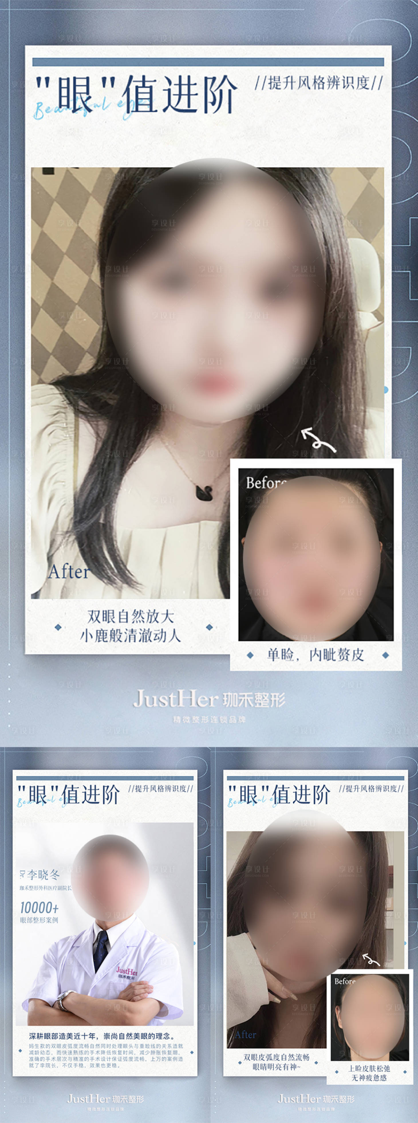源文件下载【双眼皮案例对比海报】编号：65390019096611906