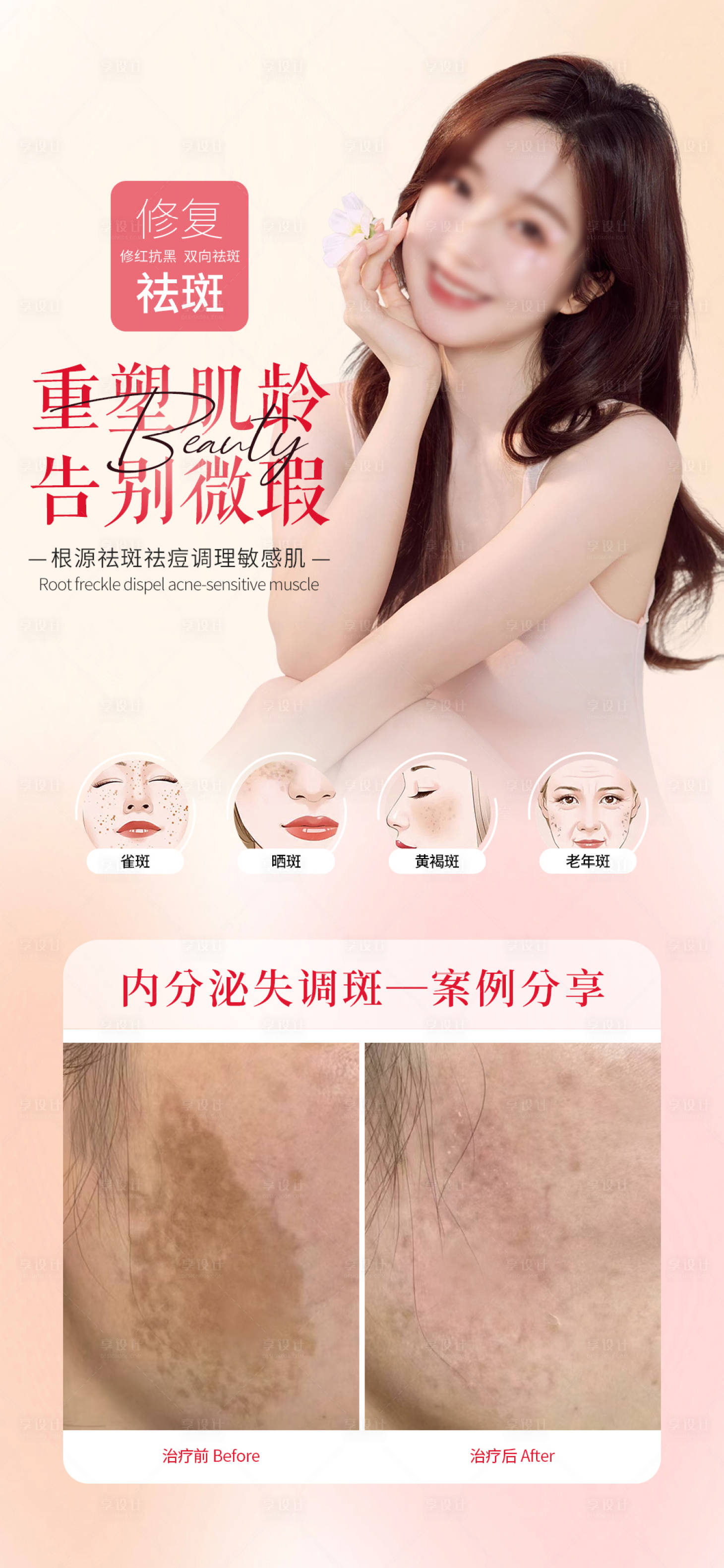 源文件下载【享设计】搜索编号：39330019277008278【医美海报】