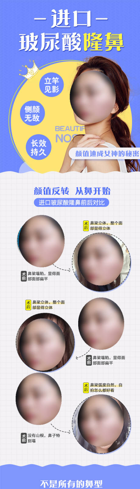 源文件下载【医美进口玻尿酸隆鼻详情页】编号：30380019197396821