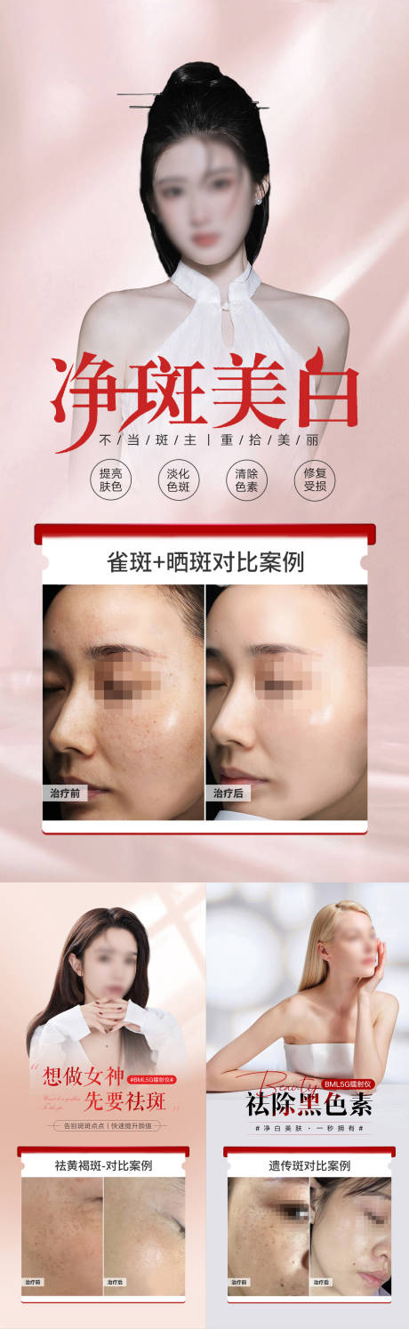 源文件下載【享設計】搜索編號：29320019404339419【祛斑案例海報】