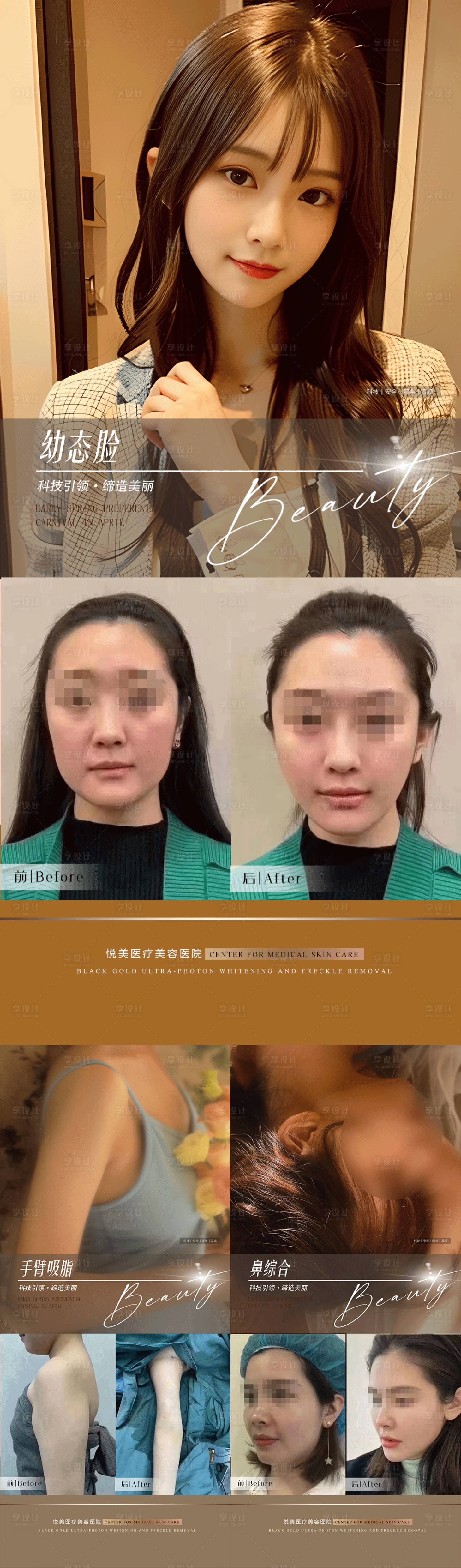 源文件下載【享設計】搜索編號：52030019489391555【醫美高端案例對比系列海報】