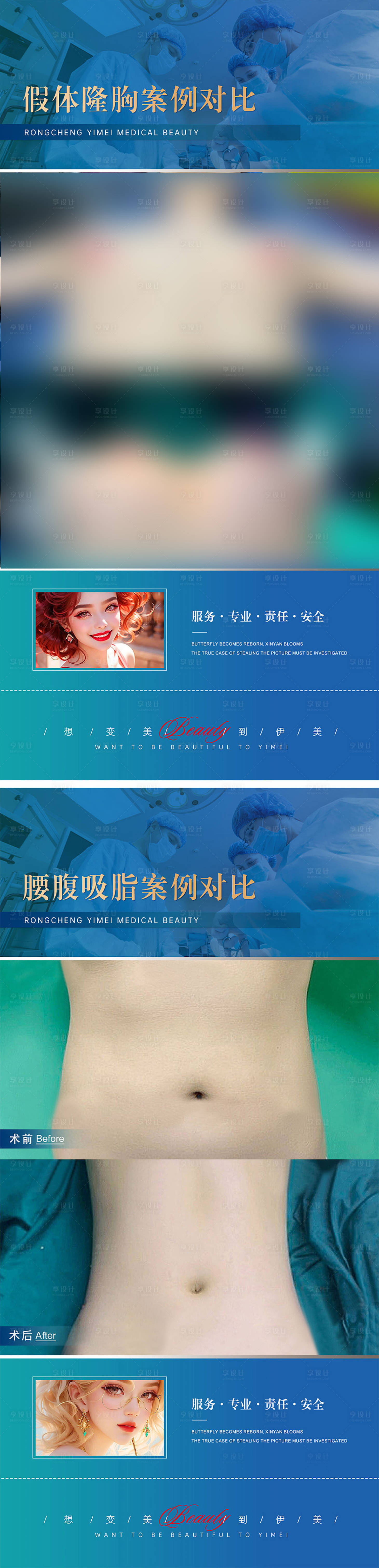 源文件下载【享设计】搜索编号：81960019555371310【医美整形案例对比模版】