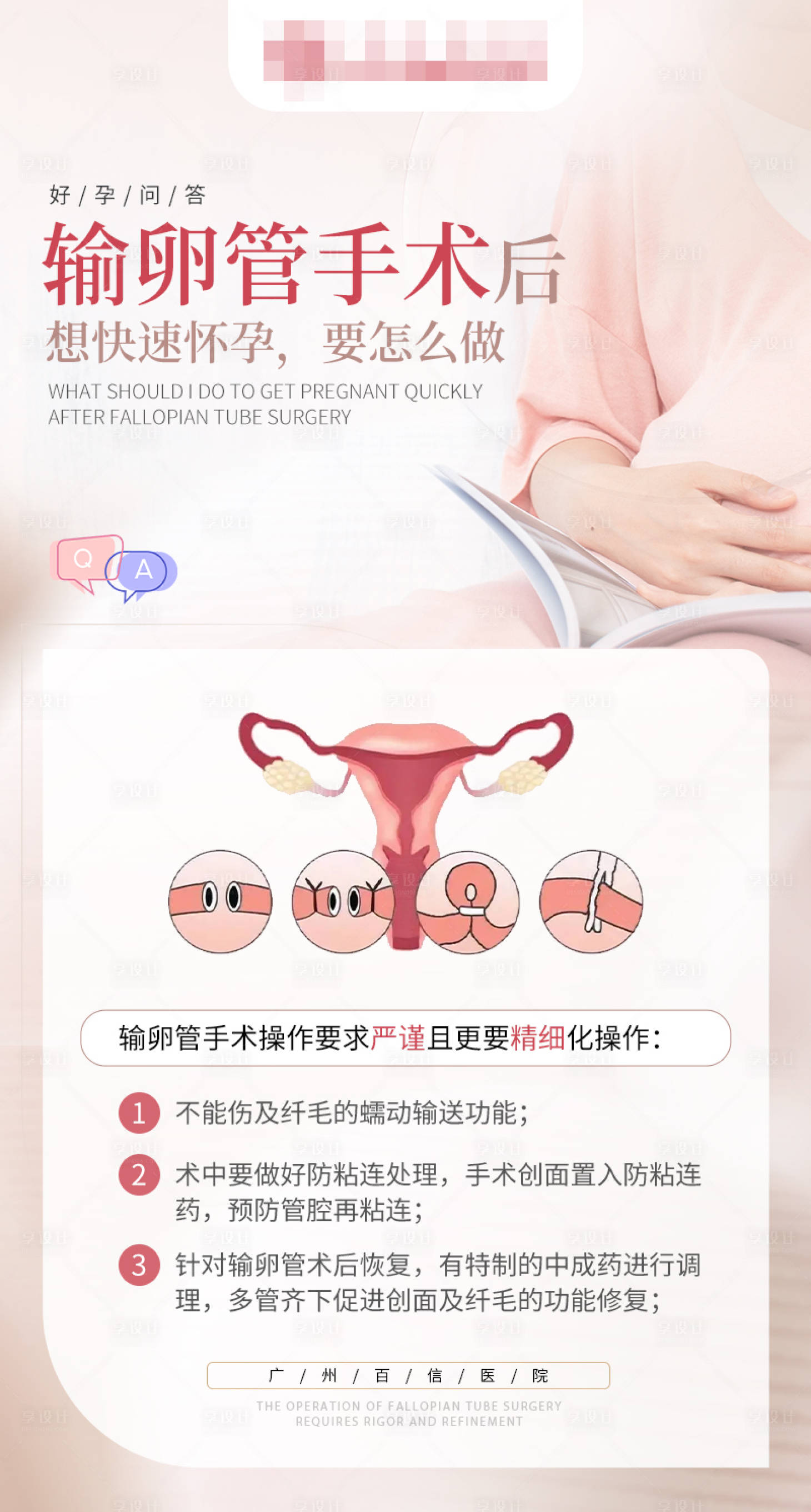 源文件下載【享設計】搜索編號：40480019251969908【輸卵管手術后科普海報】