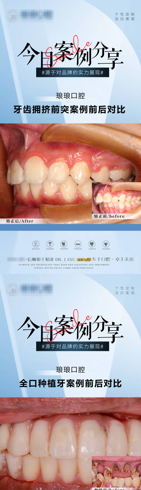 源文件下载【口腔牙齿案例海报】编号：20230907092151213