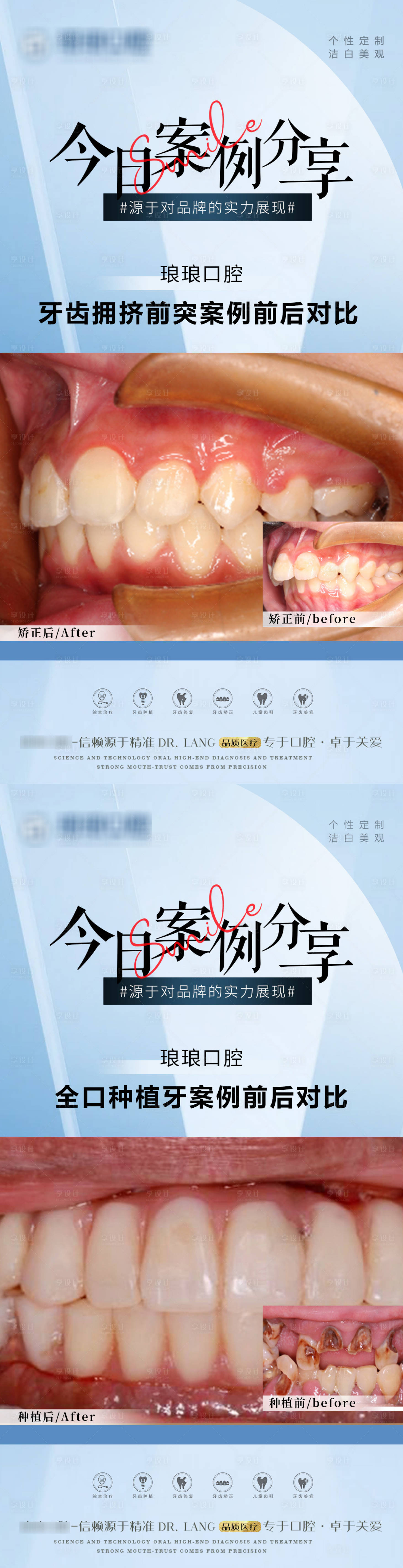 源文件下载【口腔牙齿案例海报】编号：34780019195203385