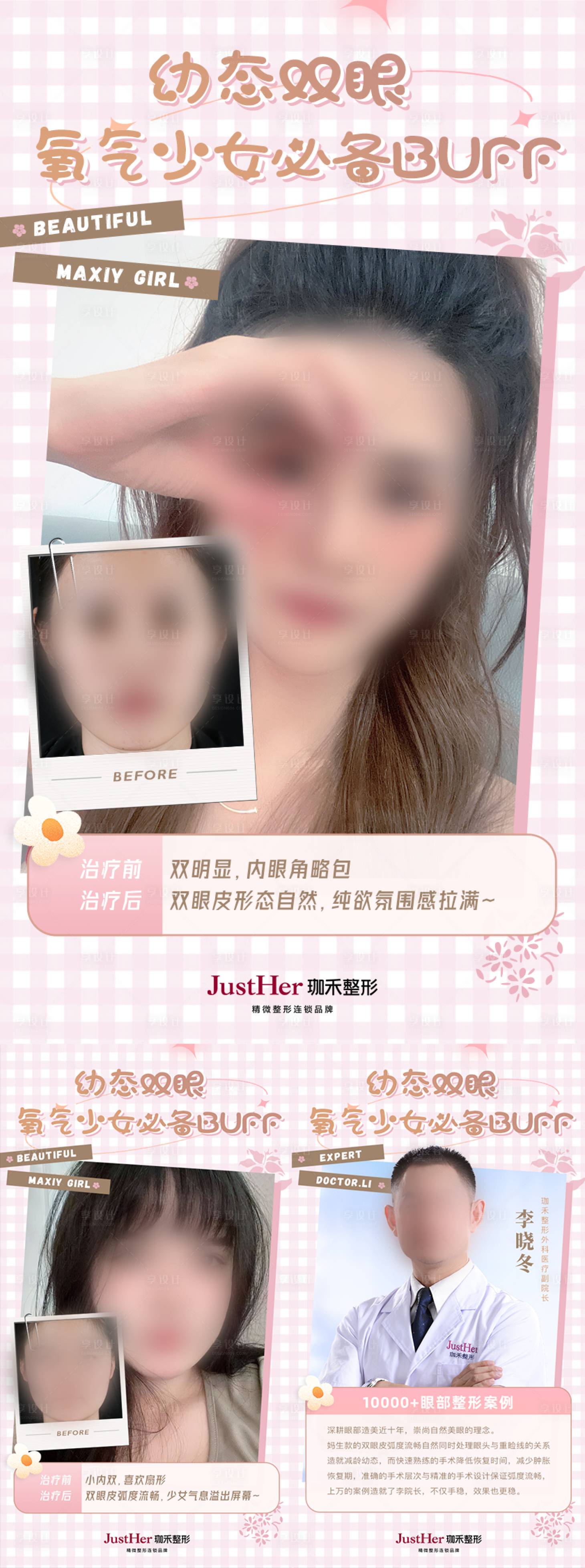 源文件下載【雙眼皮案例對比海報】編號：12730019314286796