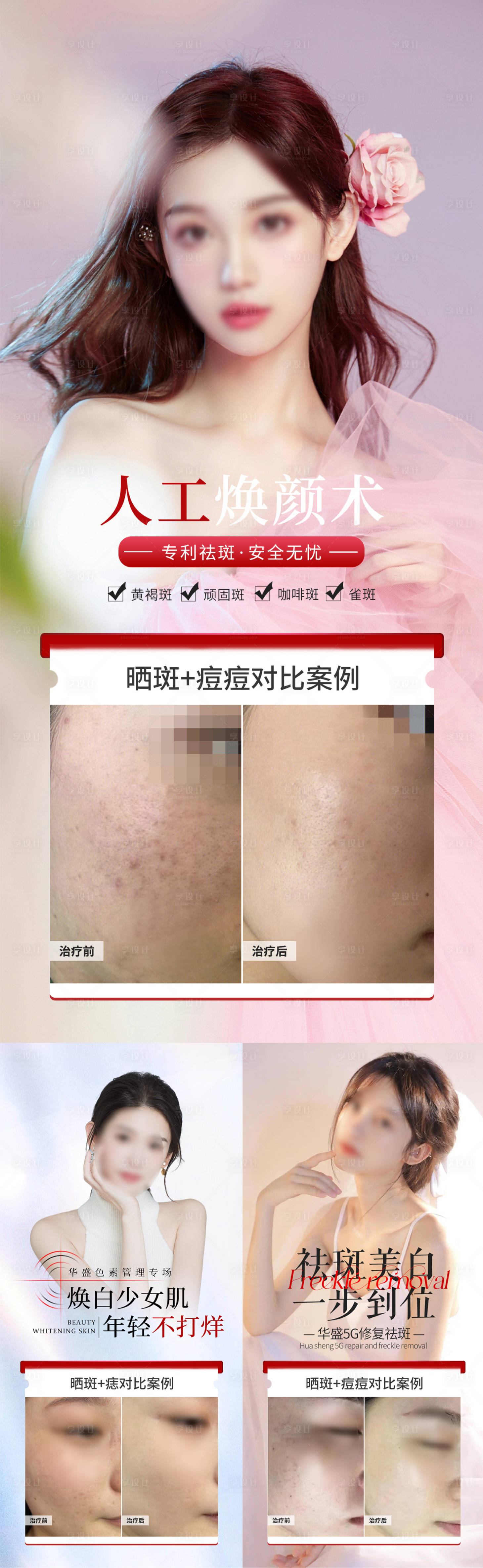 源文件下載【輕醫美祛斑皮膚管理案例海報】編號：17320019561374318