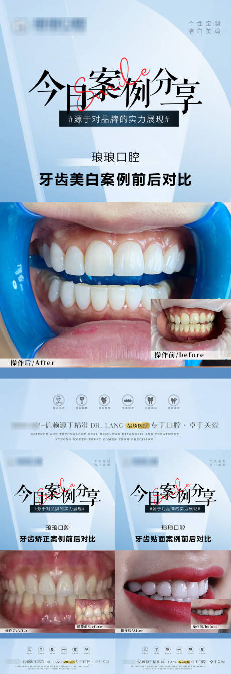 源文件下载【口腔牙齿案例】编号：88870019371246344