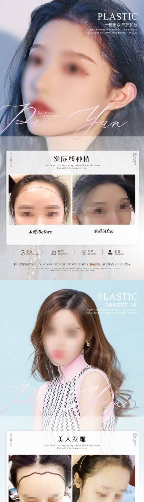 源文件下载【享设计】搜索编号：48000019282436182【植发简约案例海报】
