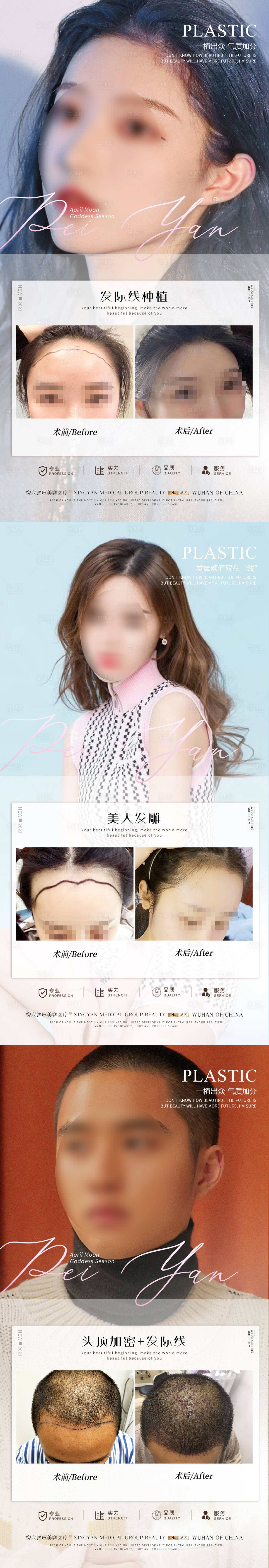 源文件下载【享设计】搜索编号：48000019282436182【植发简约案例海报】