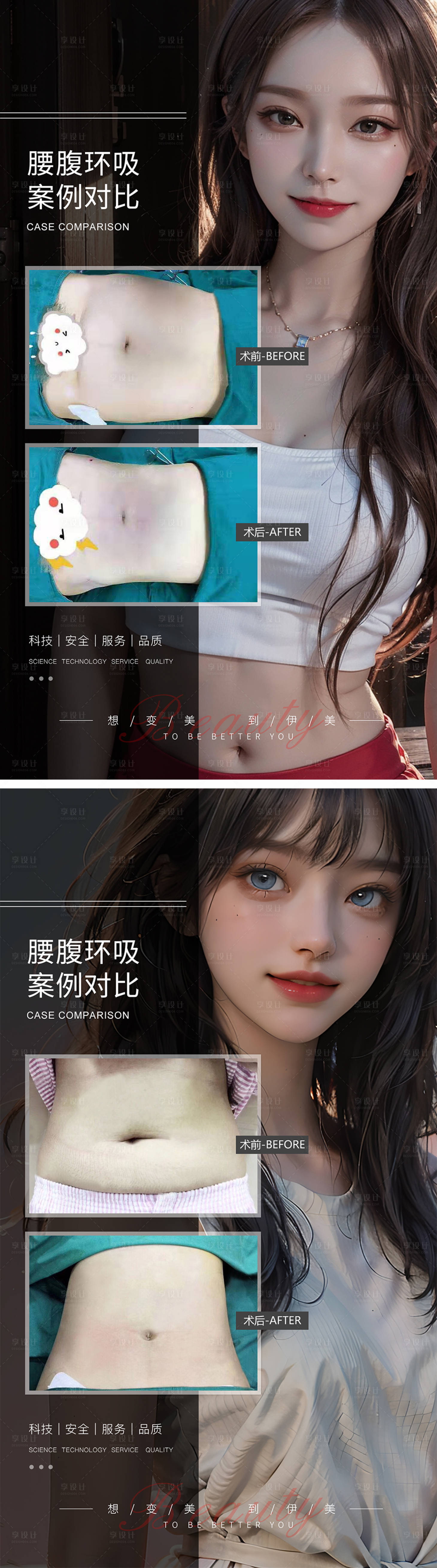 源文件下載【享設計】搜索編號：88790019298165619【腰腹脂肪環吸案例對比系列海報】
