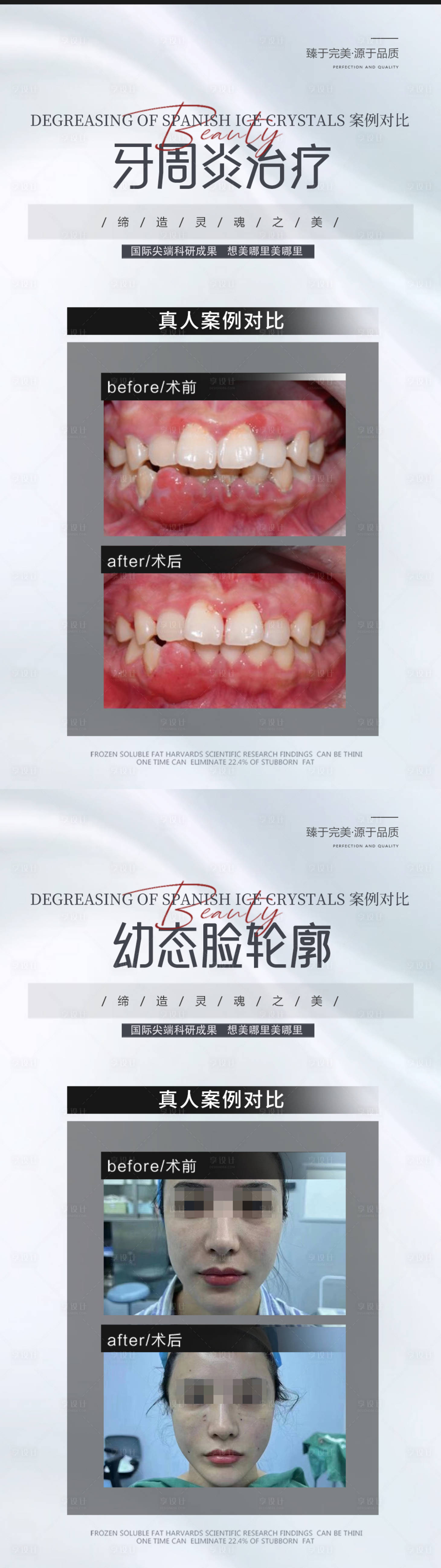 源文件下载【享设计】搜索编号：62940019491407340【整形医美口腔案例对比简约图】