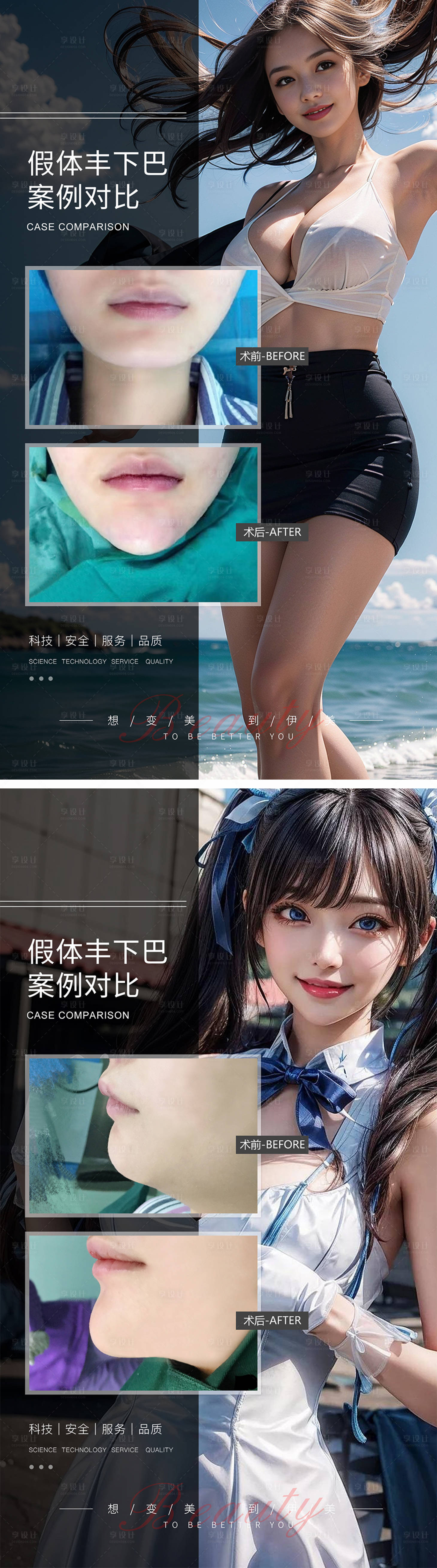 源文件下载【假体丰下巴案例对比系列海报】编号：87330019293525663