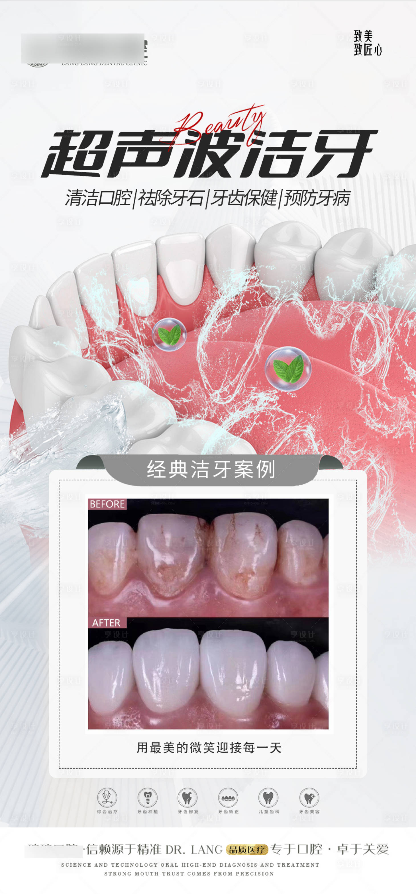 源文件下载【口腔超声波洁牙案例对比海报】编号：49230019489913902